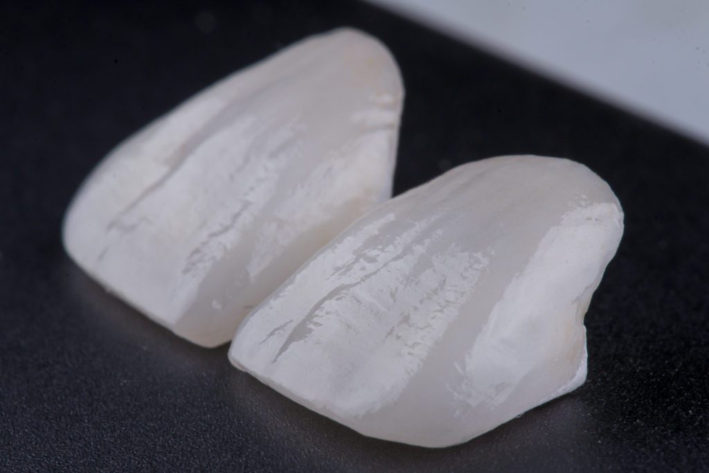 Lentes de Contato Dental Alphaville