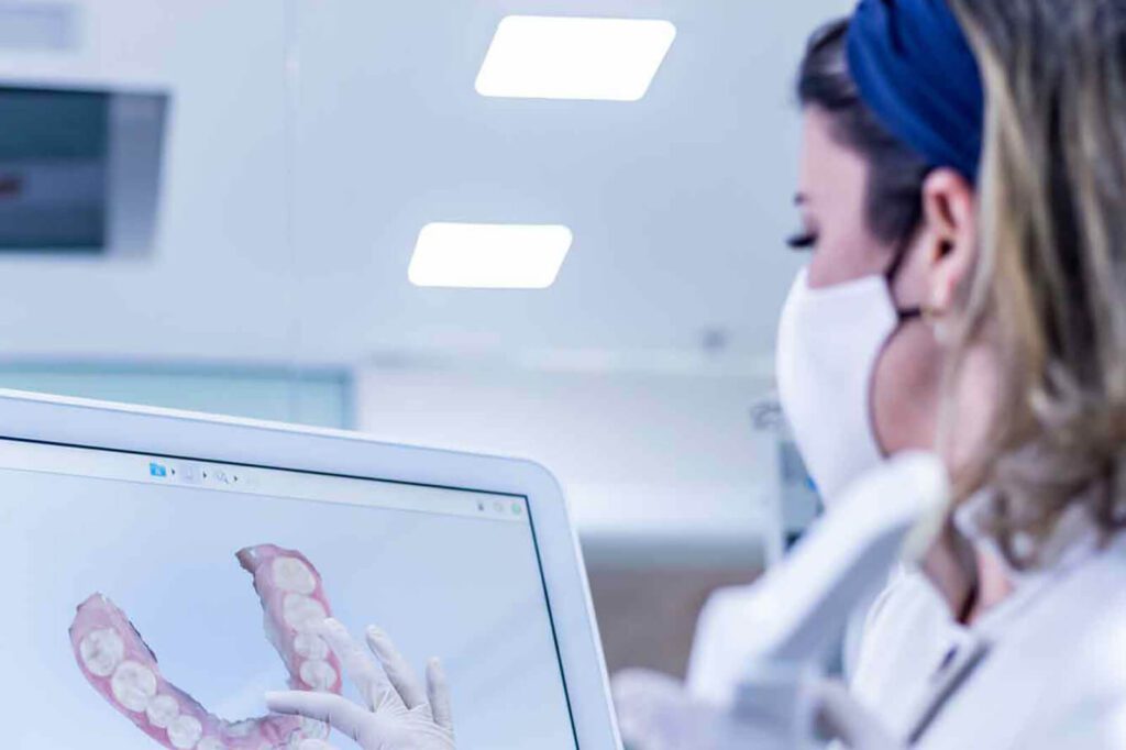 Prótese dentária premium fabricada com tecnologia 3D na Clínica Armonì em Alphaville, combinando inovação, estética e funcionalidade para reabilitação oral Lentes de Contato Dental Alphaville