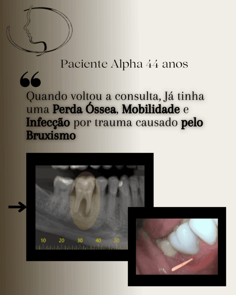 Dra. Sheila, especialista em DTM, realizando tratamento para prevenir perda óssea na Clínica Armoni em Alphaville