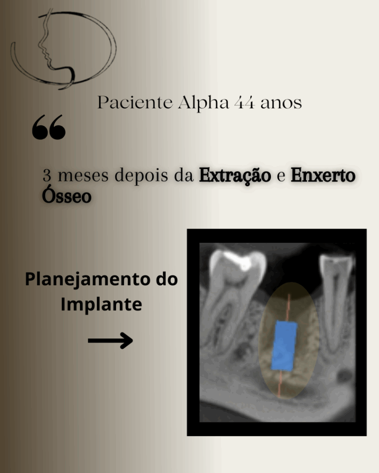DTM: Tratamento Humanizado com a Dra. Sheila e Tecnologia de Ponta