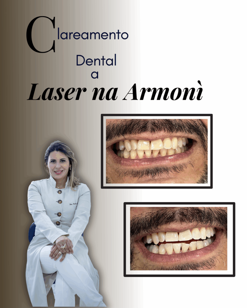 Antes e depois de clareamento dental saudável a laser realizado pela Dra. Sheila Lobo Cataldo na Clínica Armoni em Alphaville, com resultados incríveis em apenas 2 sessões
